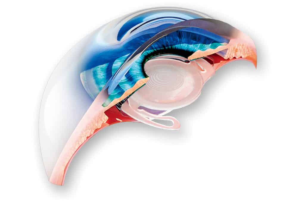 Cataract Surgery Is One Of The Safest And Most Successful Microsurgical Procedures.